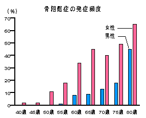 骨そしょう症とカルシウム・ビタミンK