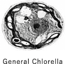 General Chlorella